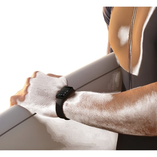 XIAOMI צמיד כושר חכם Redmi Smart Band Pro